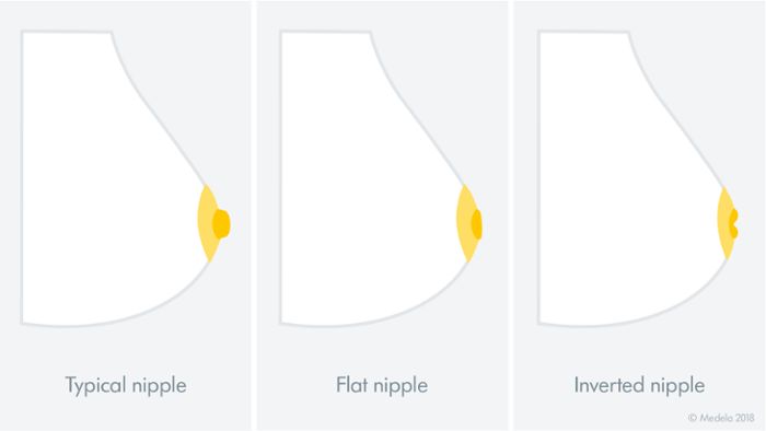 Types of nipples